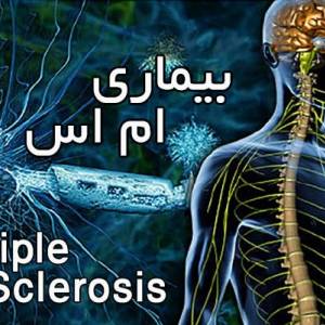 ام اس | نخوردنی های ام اس