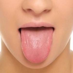 سرطان | ضرورت معاینه بیماران از لحاظ سرطان دهان